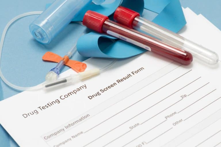 PreEmployment Drug Test A Complete Guide [2022]